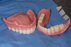 dentures15127a42786b05