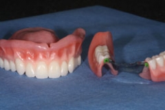 dentures25127a427b11be