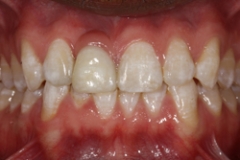 bridges25127a6508e09e