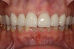 bridges35127a65032e5d