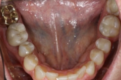 crowns15127a65051614