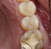 crowns25127a65070974