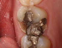 crowns35127a650b72b5