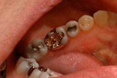 crowns45127a650d8e42