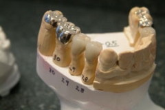 crowns55127a65105752