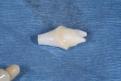 implant_abutments25127a3025d8ab