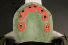 implants15127a3034278c