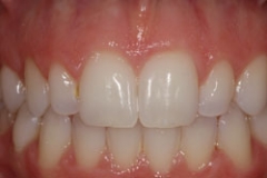 resins25127a6f083e04