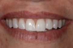 resins35127a6f068def